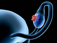 Banner do artigo